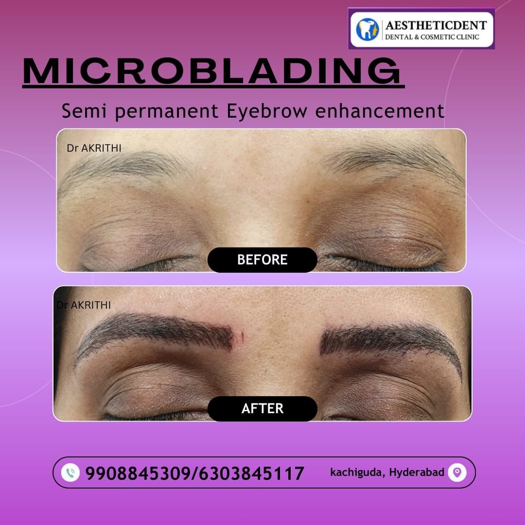 Semi Permanent Makeup for Eyebrows