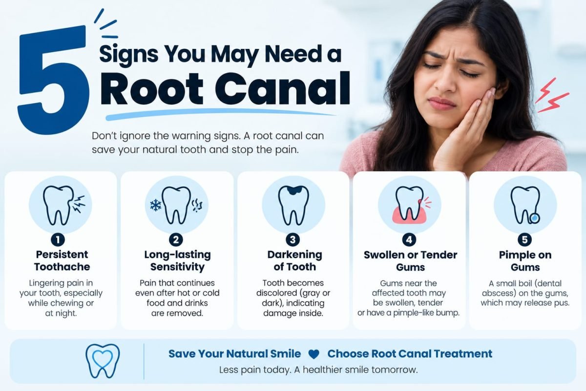 5 Signs You Might Need a Root Canal Treatment